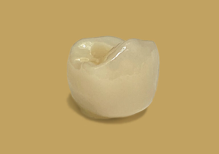 Zirconia Crowns McDade Dental Studio